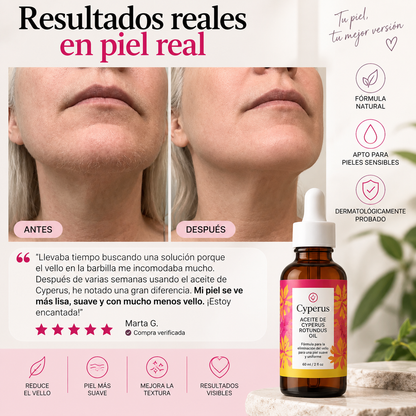 Aceite Inhibidor del Vello | Cyperus®