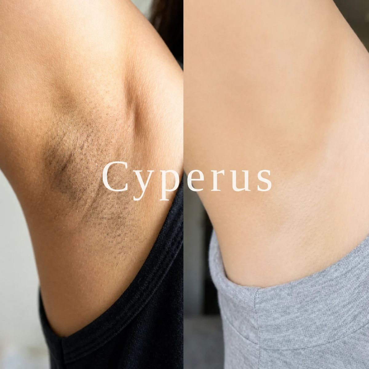 Aceite Inhibidor del Vello | Cyperus®