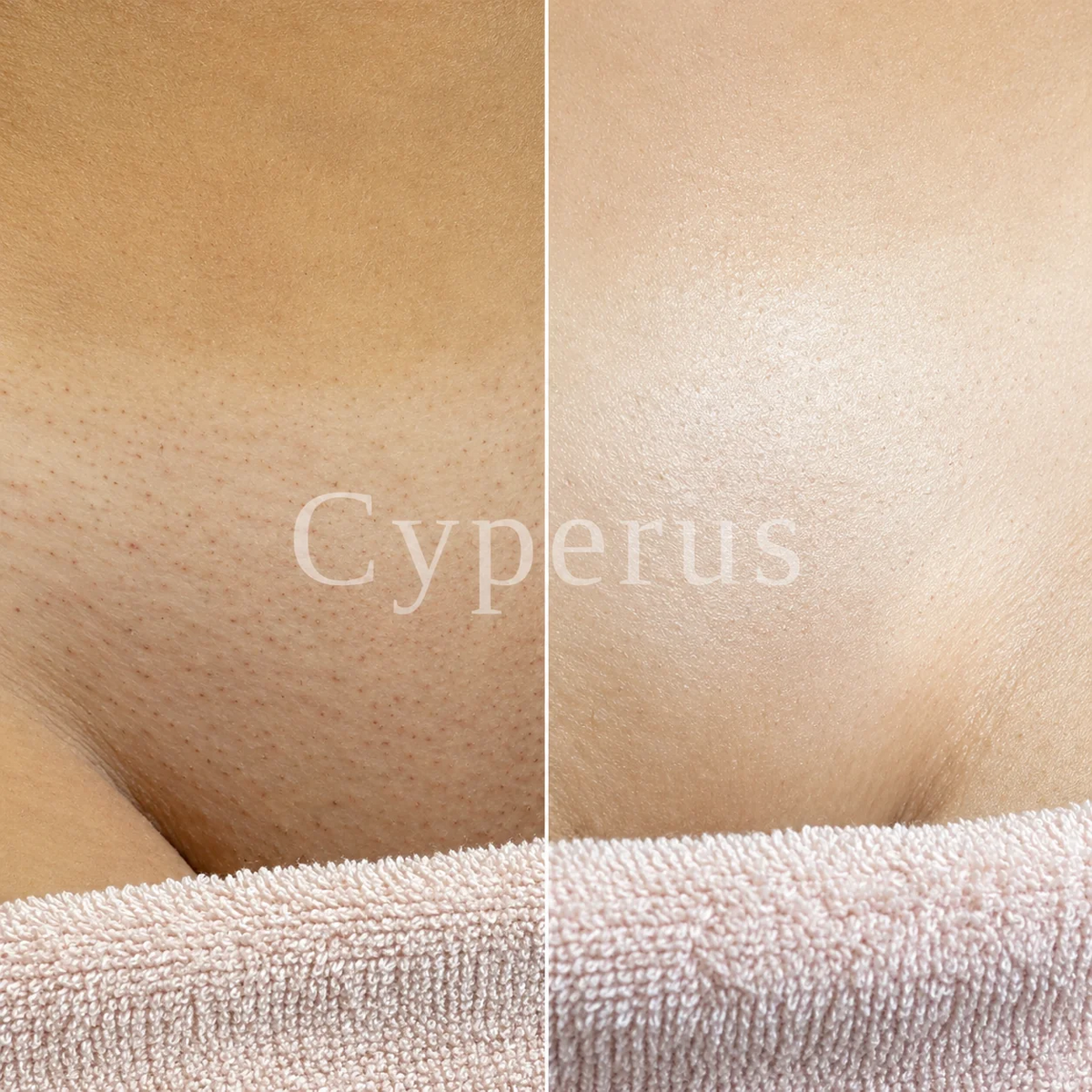 Aceite Inhibidor del Vello | Cyperus®