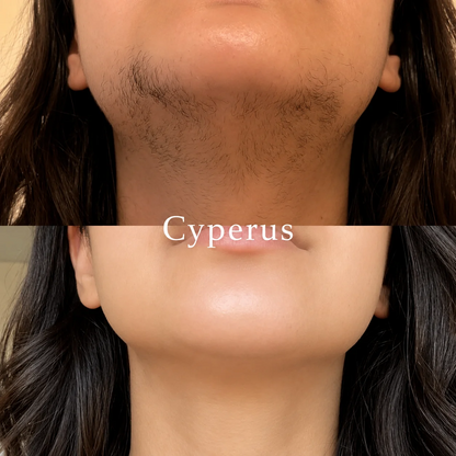 Aceite Inhibidor del Vello | Cyperus®